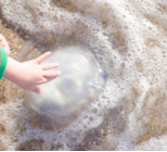 עקיצת מדוזה: מה חשוב לדעת?-תמונה